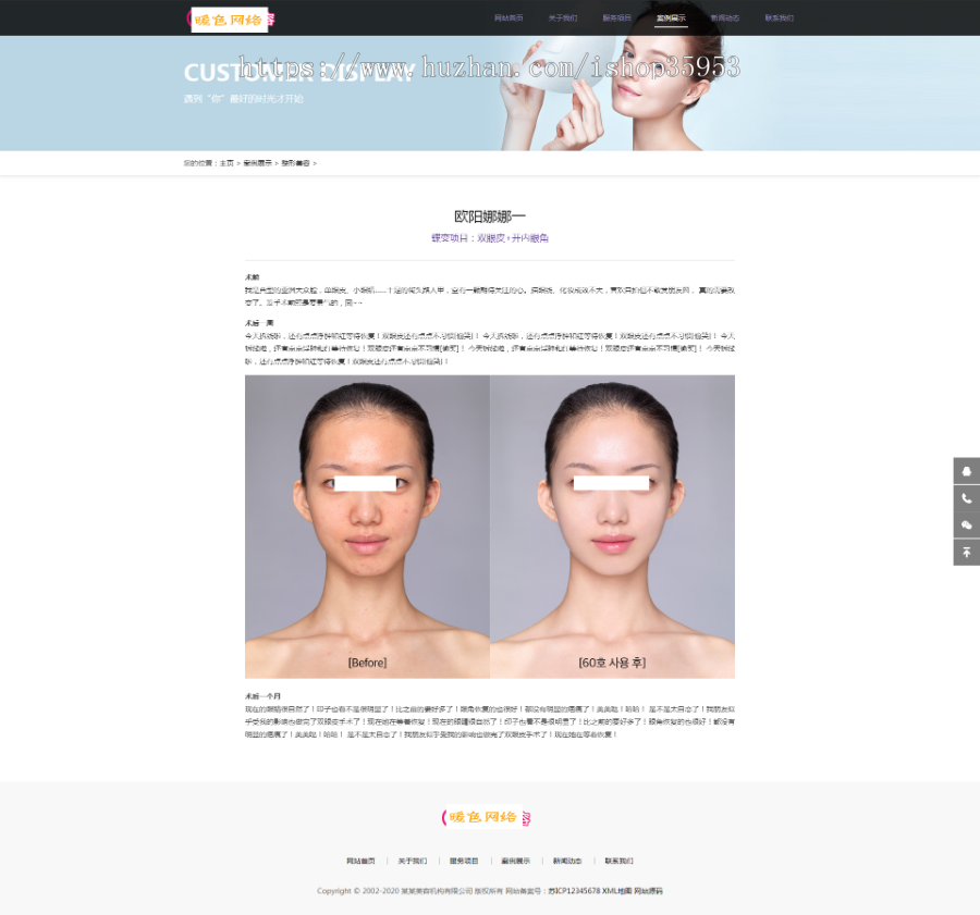（自适应手机版）响应式美容整形类网站织梦模板 HTML5医疗美容整形医院网站源码
