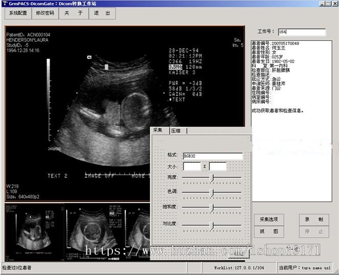 .net大型医院管理系统源码C/S架构 PACS超声科室源码 Dicom工作站