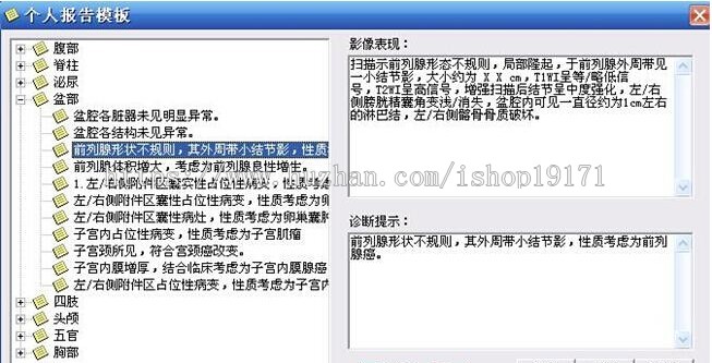 .net大型医院管理系统源码C/S架构 PACS超声科室源码 Dicom工作站
